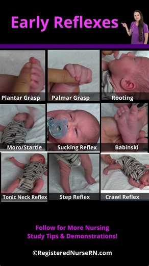 Newborn Infant Reflexes Demonstration for Nursing School Students #shorts