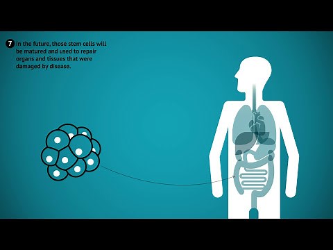 Obtaining human embryonic stem cells thru' therapeutic cloning | Video-infographic