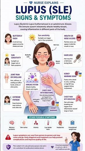 Lupus Signs and symptoms #nurseexplains #anatomy