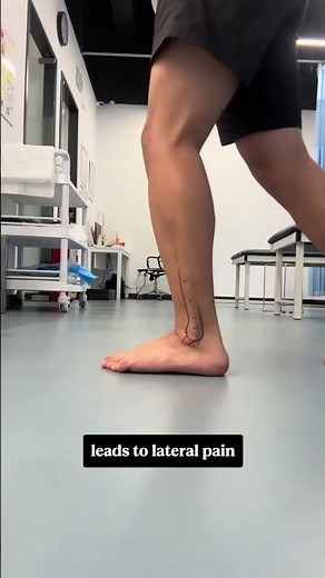 ...Still feeling outer ankle pain long after a bad sprain?