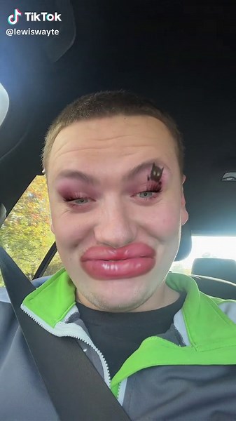 Hilarious Sausage Lips Memes | Bad Lip Fillers Funny Compilation