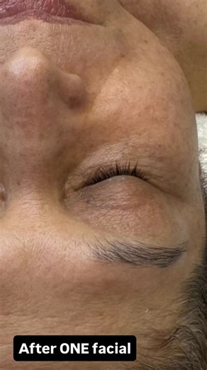 Nerida Joy | Esthetician & Skin Care Expert on Instagram: "Does your skin look tired? Lacking skin tone.? Blotchy with premature lines? I did one facial on her, massaging her skin for 30 minutes:)) Here are the four products you need Confidence by Nerida Joy cleanser, Rejuvi q flavonoid (pm), g aha cream (pm) and the Rejuvi eye gel. Shop Educateyourskin.com #movementismedicine #winterskin #dryskin #darkeyes"