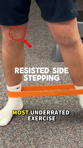 Tony Maritato on Instagram: "This video shows a young athlete early after arthroscopic knee surgery working on resisted side stepping using a loop band. . Side stepping is one of the best ways to safely reintroduce athletic movement because it activates the hips without putting excessive stress on the knee joint. . Resisted lateral stepping specifically targets the gluteus medius and other hip stabilizers. Warming up these muscles improves pelvic control, knee alignment, and balance—all of which