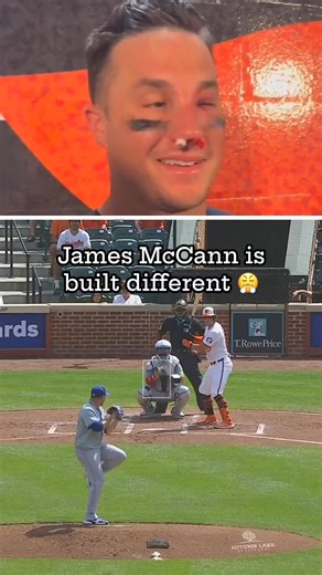 James McCann took a 95mph fastball to the face and stayed in the game 😳 | MLB on FOX