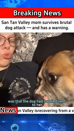 Arizona Mom Survives Vicious Dog Attack — Her Warning Could Save Someone’s Life! Watch full video in the first comment! | Real Cops