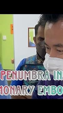 Steps for using Penumbra In Pulmonary Embolism
