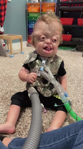 Raedyn gets CPT(Chest Physical Therapy) twice a day, better known as airway clearance. He wears this little vest that shakes up any mucus thats built up inside his lungs. It has such an important job, but he thinks its so fun. I get a kick out of his little voice!