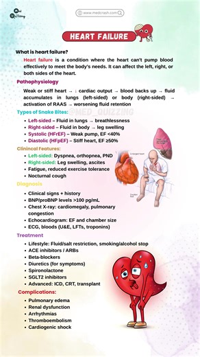 Unlocking Medical Knowledge with Flashcards and Mnemonics