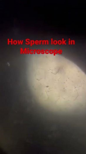 Dog Sperm analysis under microscope
