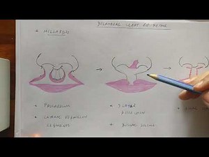 Cleft lip:part 4 (Bilateral cleft lip)