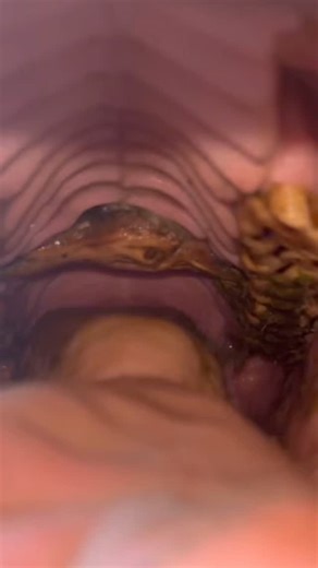 Brennan Fitzgerald Lee, DVM on Instagram: "This cutie patootie roping horse presented at DOUBLE DIAMOND VET today for head shaking. I think I found the culprit 😳😆! WOW…that’s a first for me! . #ropehorse #veterinarian #doublediamondvet #horses"