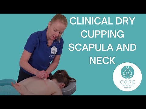 Clinical Dry Cupping Scapula & Neck - #drycupping techniques