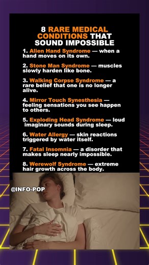 8 Rare Medical Conditions That Sound Impossible