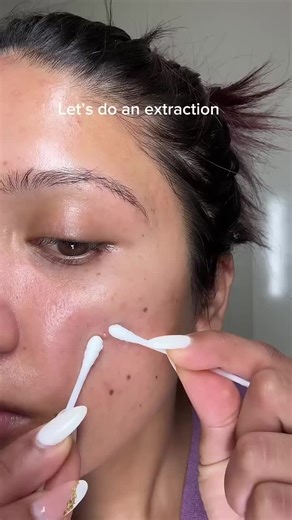 Got a pimple at the worst moment? Just place this patch before going to sleep… And in the morning 😳 The pimple looks smaller and calmer. ✔ Absorbs impurities ✔ Reduces redness ✔ Invisible on the skin Wake up with clearer skin ✨ Available now in our store 🔥 link in bio ❤️ #pimplepatch #acnepatch #skincare #skincaretips #tiktokmademebuyit