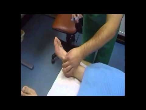 Foot Surgery Toe Straightening Procedure
