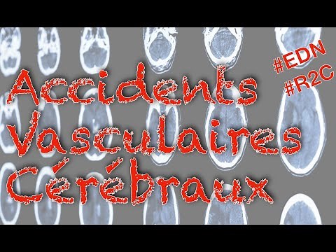 Strokes (item 340): What you need to know for the EDN