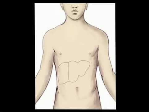 Portal Vein Embolization (PVE) for Contralateral Liver Hypertrophy