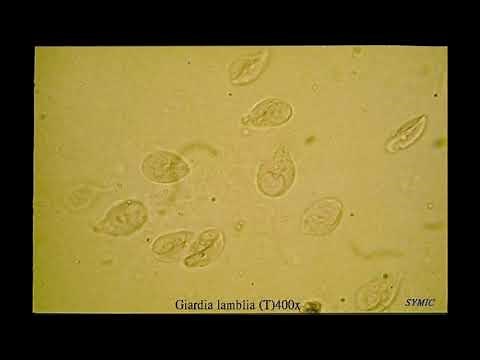 Enterotest- test for giardia Lamblia