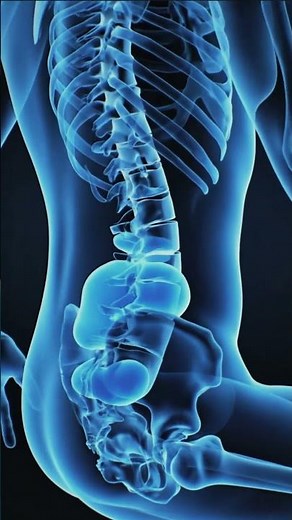 “Standing Desk vs Sitting: What It’s Really Doing to Your Spine”#Health#HealthAwareness