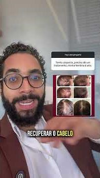 Qual o melhor tratamento para quem sofre com Alopecia?