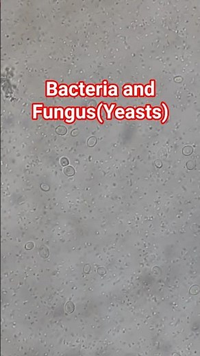 Bacteria and fungus under the microscope #microscope #shorts