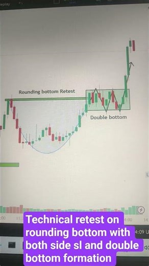 Intraday chart multiple pattern