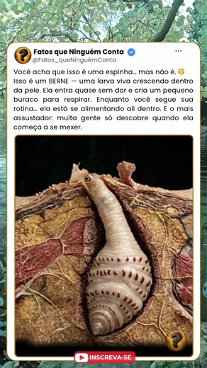 Isso cresce DENTRO da sua pele 😳 #curiosidades