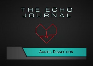 The Assessment of Aortic Dissections