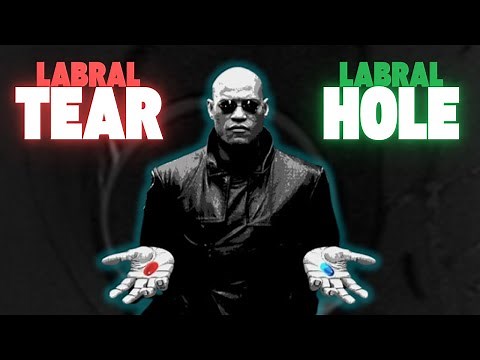 Hip Labral Tears: The Hidden Dangers of MRI Overdiagnosis