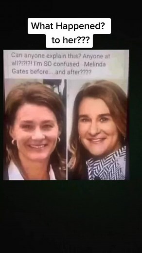 #melindagates #whathappened #pleaseexplain
