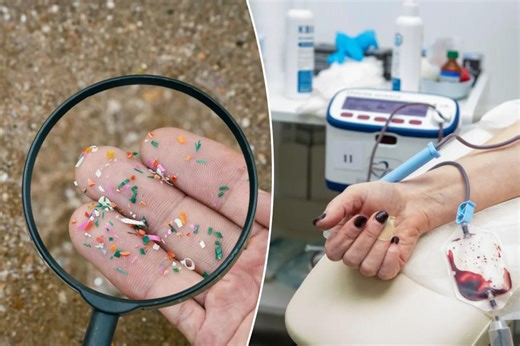 Microplastics could be removed from our bodies with blood filtering technique