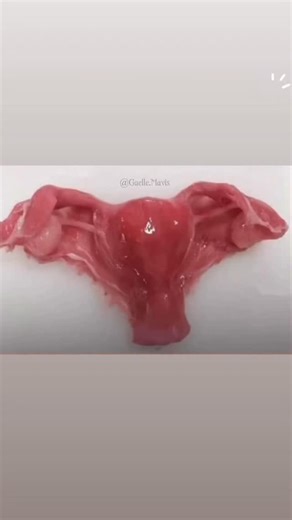 28K views · 76 reactions | Ever wondered? #nursing #nursingschoolproblems #nursingstudentlife #women #fibroids #womenshealth visuals by endodoute. { nursing , nursing school hacks , study tricks } | Mastering Nursing | Facebook