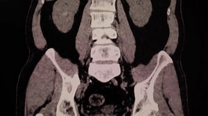 Tomografia computadorizada por multisserviços de cálculos: vídeo stock (100% livre de direitos) 3732314539 | Shutterstock
