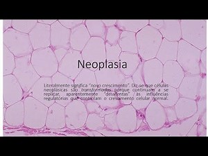 Neoplasia