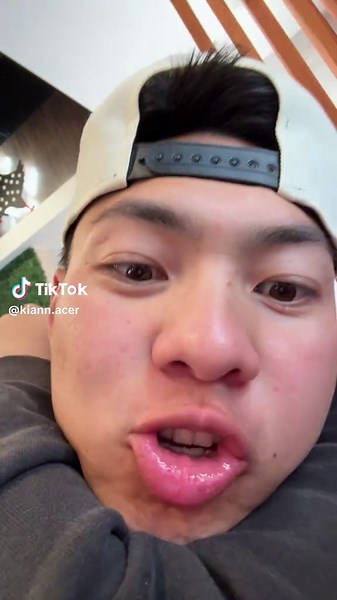 lagi na lang dumadaan sa fyp ko 💖 | Coconut