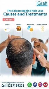 The Science Behind Hair Loss: Causes and Treatments Know More about it👇 https://www.igraftglobalhairservices.com/the-science.../ ☑️Click on the link in bio and book your appointment. with igraft global hair and skin service Visit our website for additional information. https://lnkd.in/dWjTJjwp Or call on the number 918237199222 We're always ready to help you. #hairtransplantation #haartransplantation #greffedecheveux #transplantecabelo #transplantecapilar #turkeyhairtransplant #beardtransplant 