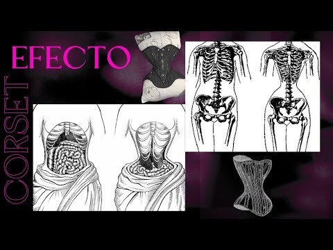 EFECTO CORSET )( 1 ESCUCHA- TÓXICO .•°☆- Aloinsubconscient 