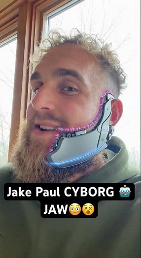 Jake Paul: Gets BIONIC JAW 😳 #boxing #funny #jakepaul #clips #ufc #fyp #shorts #short #bionic