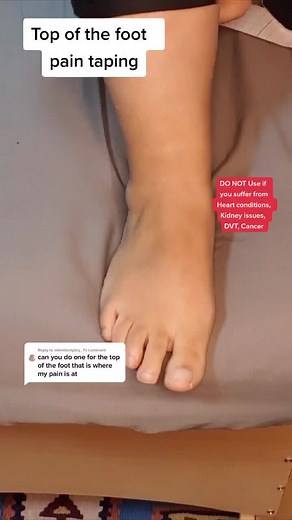 Top of the Foot Pain Relief: Step-by-Step Guide