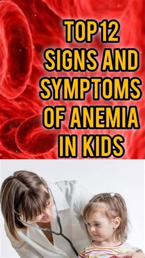 Top 12 Warning Signs Your Child Might Have Anemia!#Anemia#AnemiaInKids #shorts