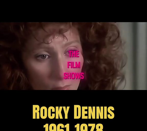 The Mother Of Rocky Dennis Revelas Some Truths #mask #rockydennis #cher #rockydennistiktok