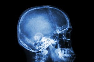 Pruebas médicas para deportistas: estas son las más frecuentes