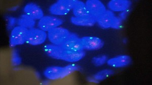 UK To Launch Pioneering DNA Study