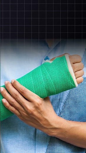 BMD Test (DEXA Scan) Explained in 60 Seconds | Bone Strength Check