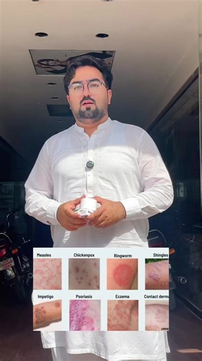#organoclinic #fyp #saffronsoap #antifungal #allergy