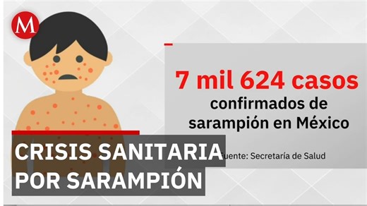 Sarampión en México supera 7 mil 600 casos y deja 26 muertes