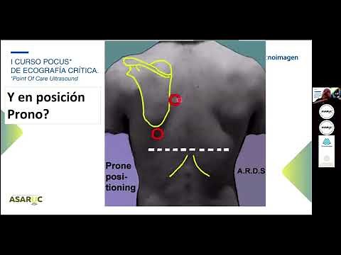 Ecografia Pulmonar en el POCUS