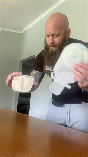 Let’s talk about two different types #stoma #ostomy #foryoupage #facebookviral #fyp #CrohnsDisease Coloplast Salts Healthcare@top fans | Crohn's Ostomy Life