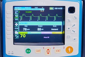 經皮體外心臟節律器