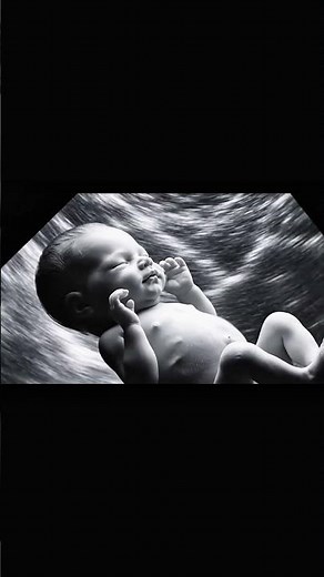 Realistic 3D Ultrasound Animation: Baby Moving in Womb (4K Medical Visualization)